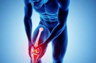 колено сустав артрит